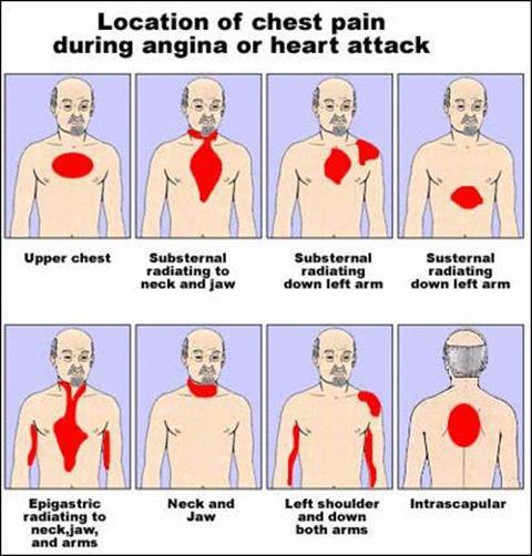 upper chest discomfort